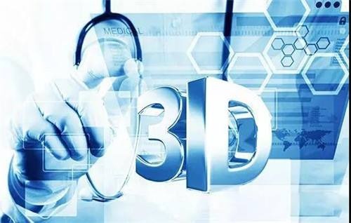 Five major differences between 3D printing technology and injection molding technology